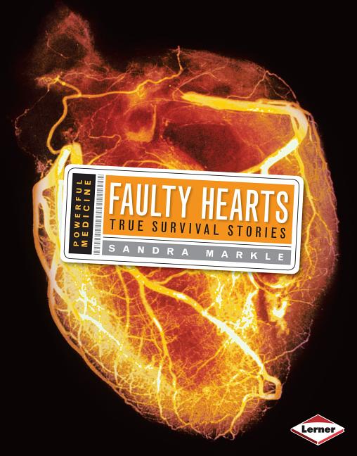 Faulty Hearts: True Survival Stories